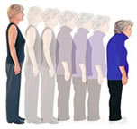 Osteoporose Haltung